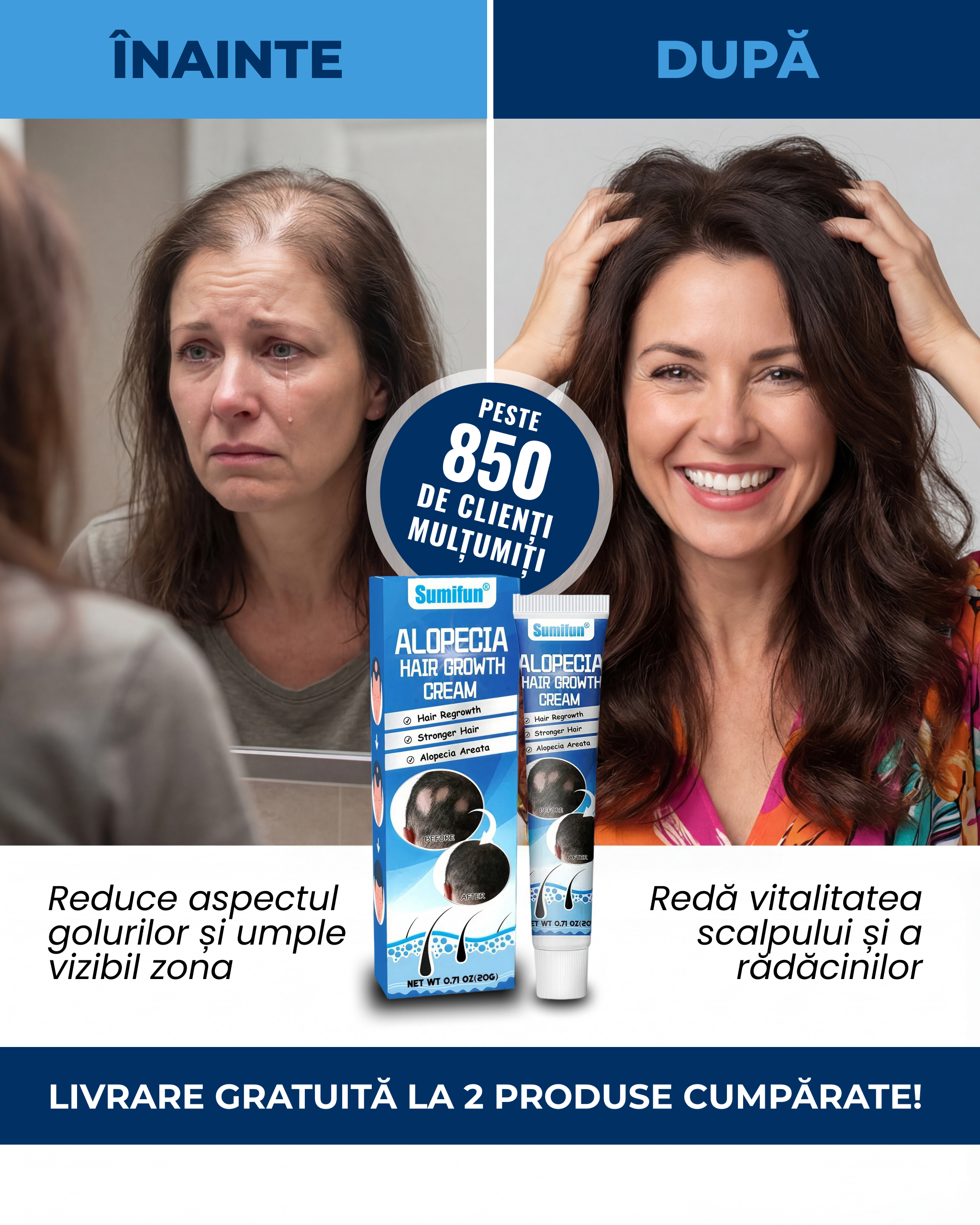 Crema Alopecie Par