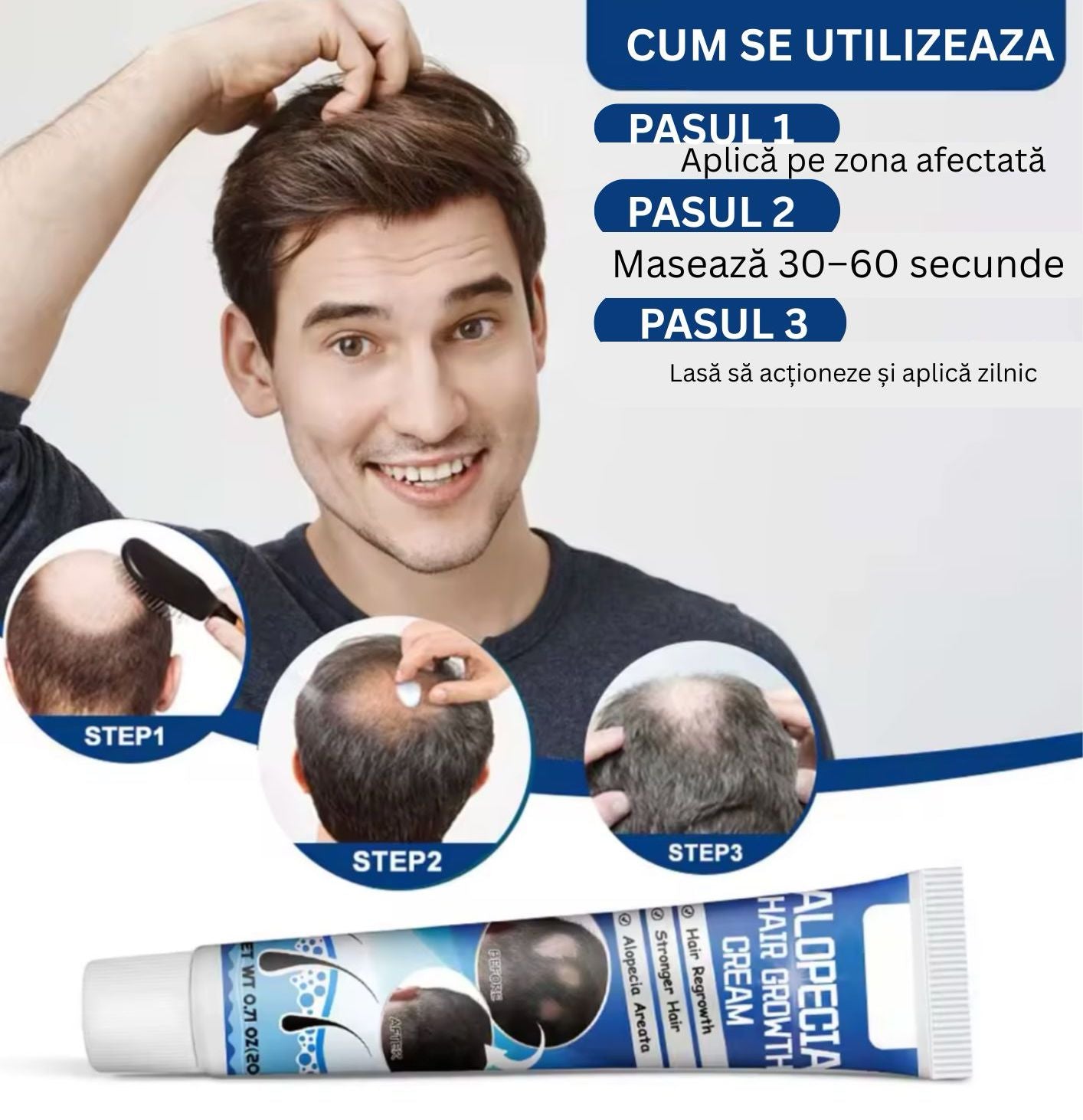 Crema Alopecie Par