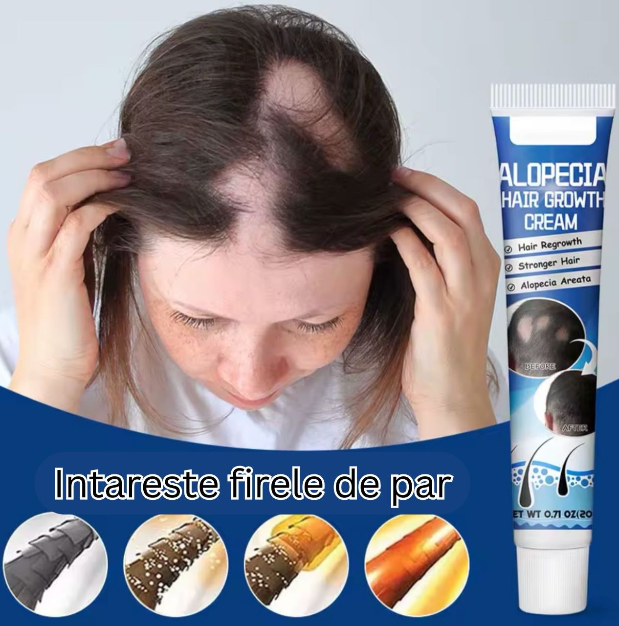 Crema Alopecie Par