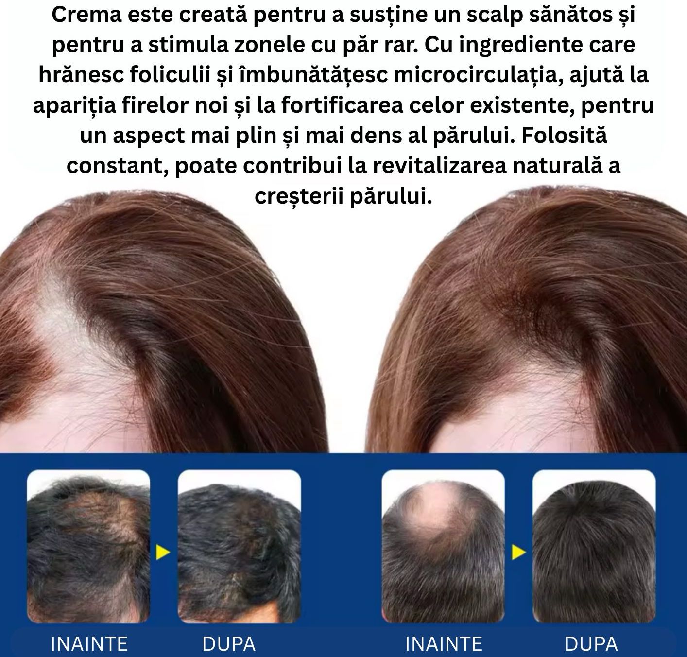 Crema Alopecie Par